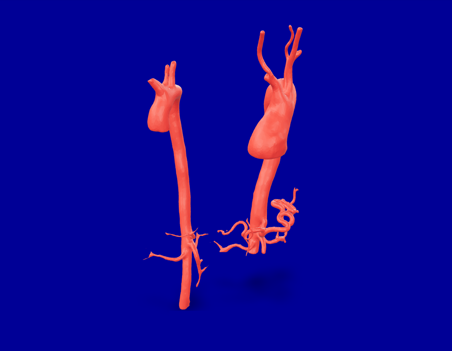 2aorta